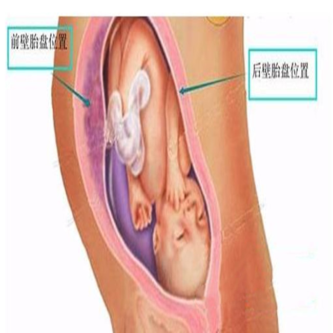 前壁和后壁好生吗,前壁好生还是后壁好生有哪些依据
