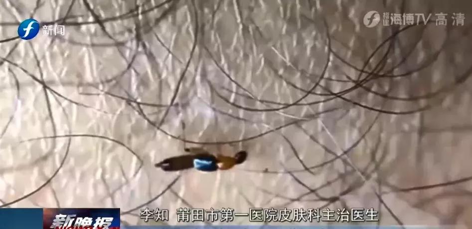 户外远离虫子的方法,哪些虫子在户外小朋友是不能碰的