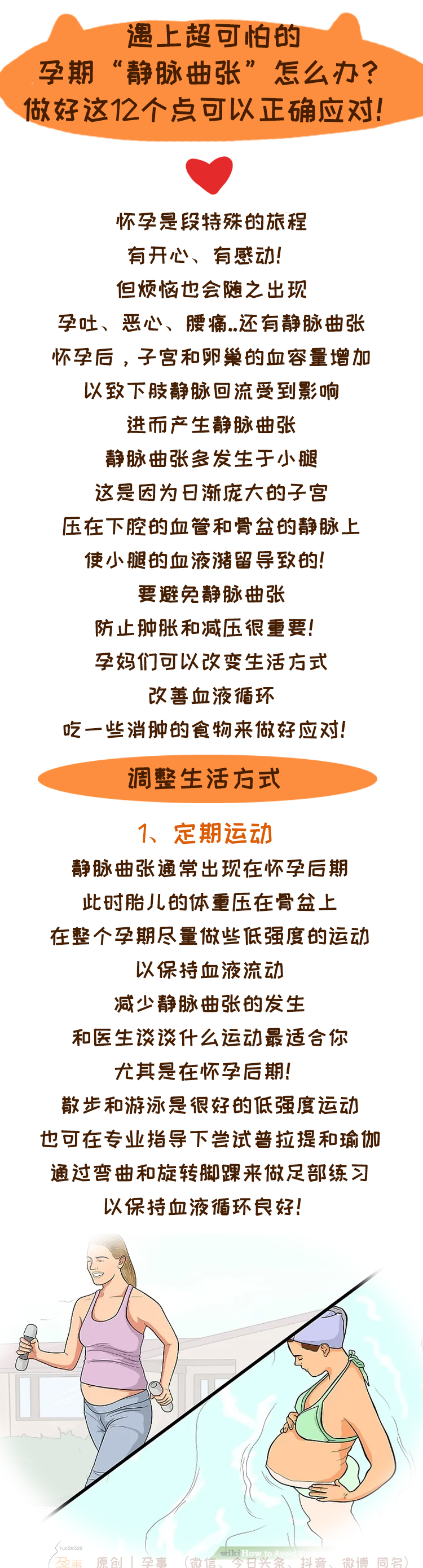 孕期静脉曲张一只脚肿一只脚不肿,孕期外阴静脉曲张厉害产后会好吗