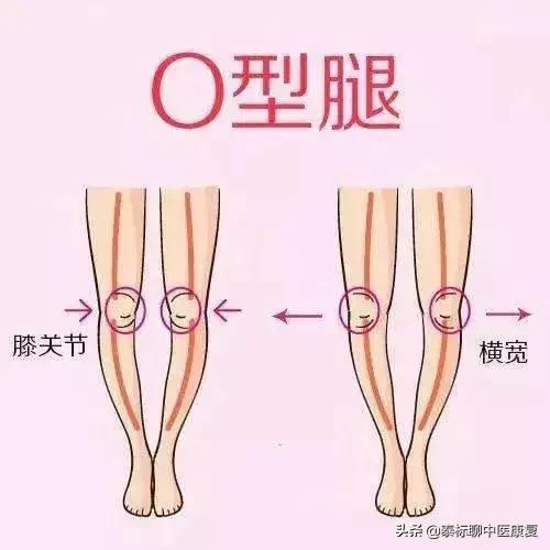 膝关节增生疼痛偏方,四神煎治膝关节疼痛