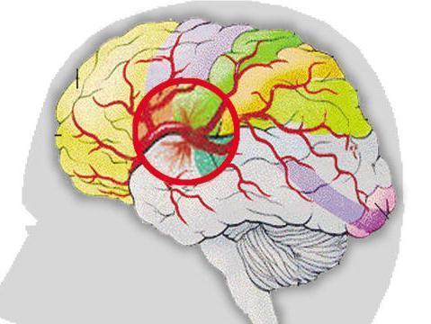 麻醉延迟苏醒的原因和处理,全身麻醉苏醒延迟最常见的原因
