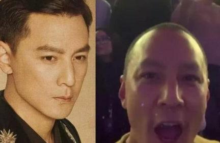 秃头少女拯救世界,秃头女孩的救命方法