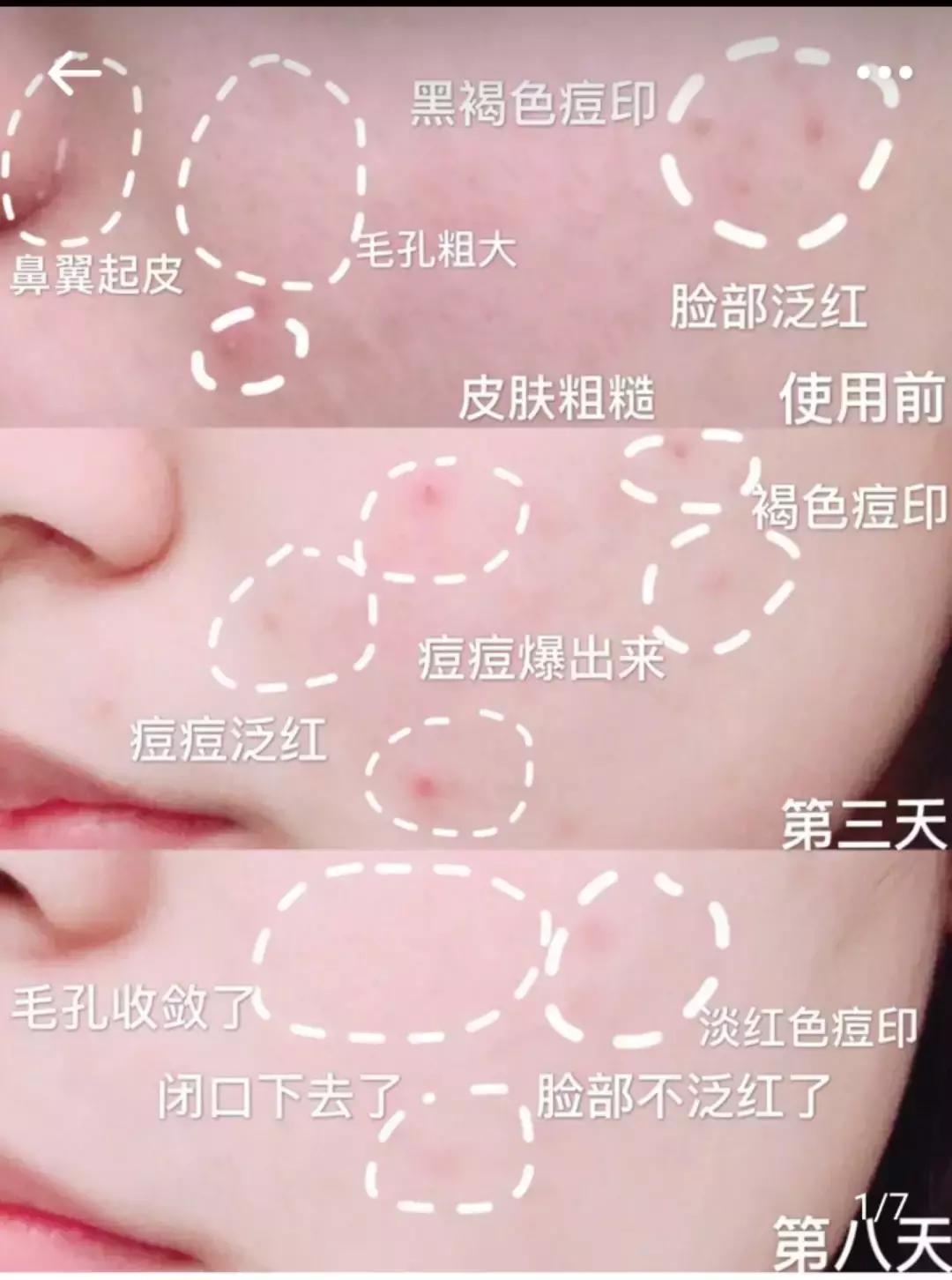 新出的不老神药叫什么,好用的干粉抖音火爆款