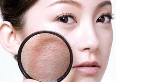 好用的网红爽肤水,6款网红爽肤水