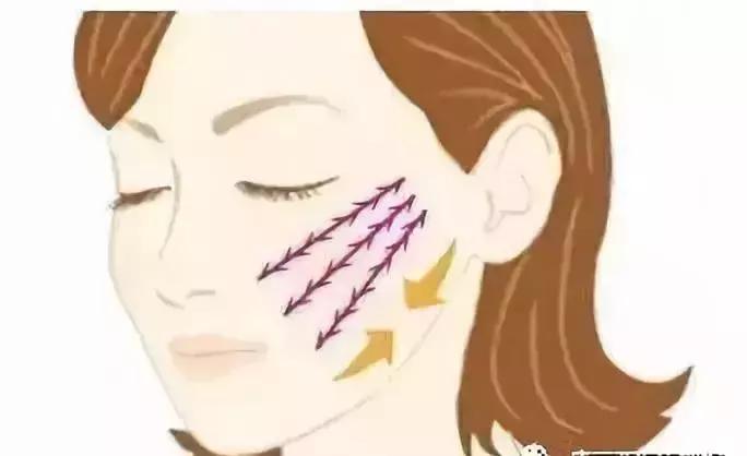 线雕5年后的变化图片,做了线雕以后的注意事项