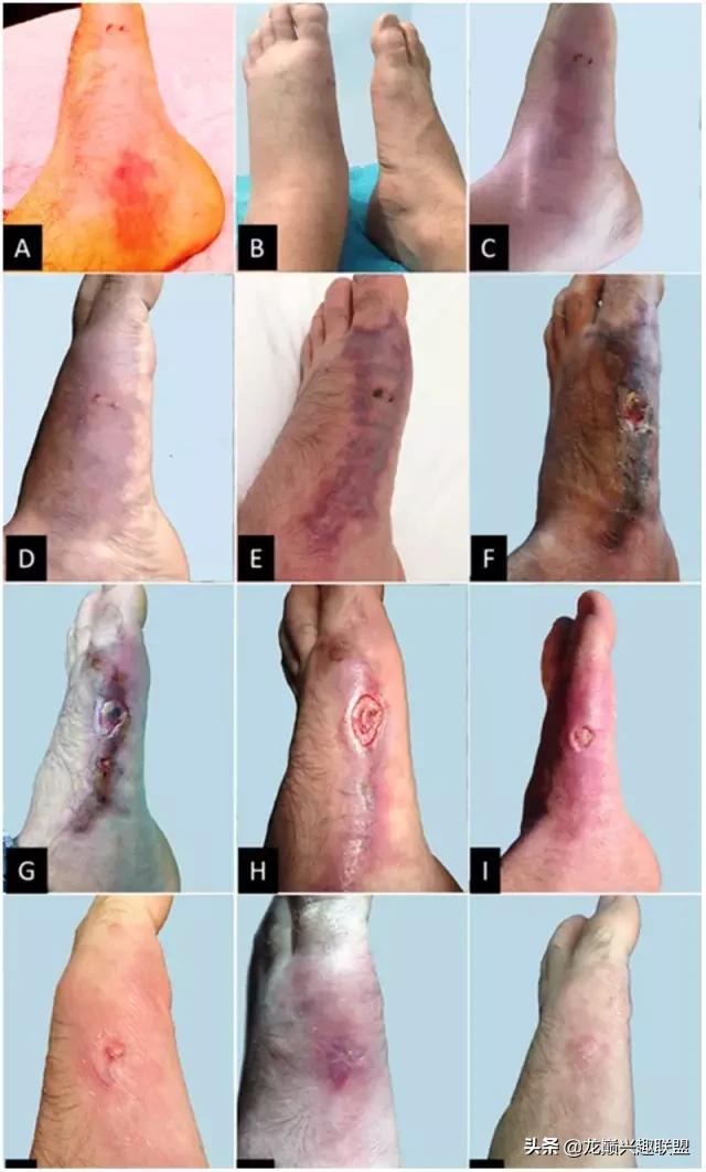 魟鱼活泼,魟鱼胆子小表现