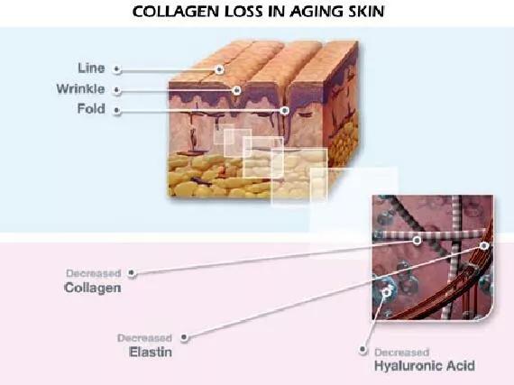 法令纹和苹果肌下垂哪个更显老,脸上肉多但是下垂