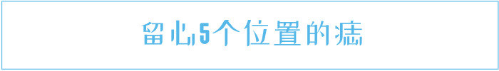 痣的颜色深浅不一是不是黑色素瘤,身体5种痣谨防是黑色素瘤需留意