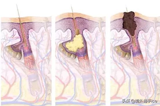 科颜氏亚马逊白泥面膜,科颜氏亚马逊白泥面膜怎么用的