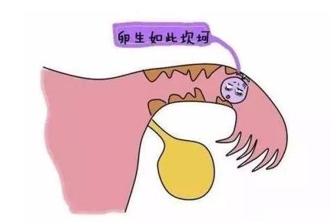 输卵管堵了怎么解决,输卵管堵了怎么办呢