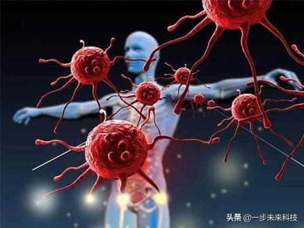 生物力学定制鞋垫,生物力学矫形鞋垫定制系统