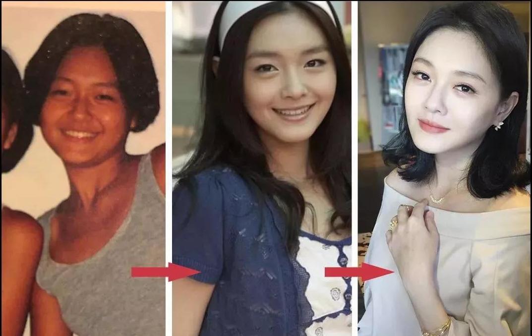 中国人去泰国打美白针,泰国美白针真实事件