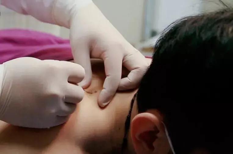 偏头痛太痛苦了,被偏头痛折磨得苦不堪言