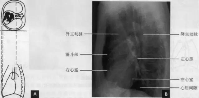 收藏：详细的胸部X线解剖，最基础最实用