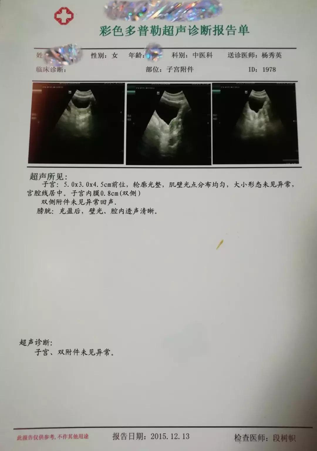 减肥日记100个视频,减肥日记女200多斤