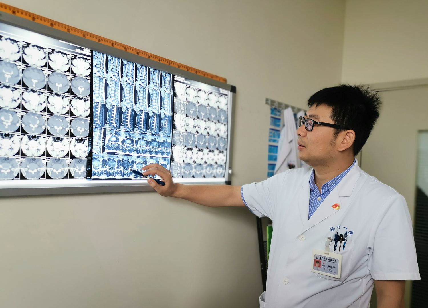 腰突微创术后怎样进行康复锻炼,腰突微创手术一个月后如何锻炼