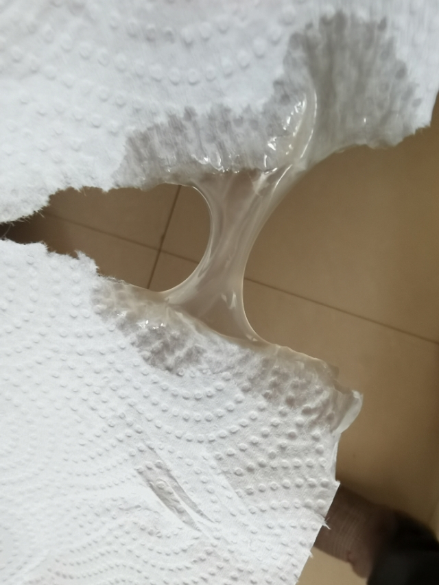 狗狗子宫蓄脓手术危险吗,狗狗子宫蓄脓吐怎么回事