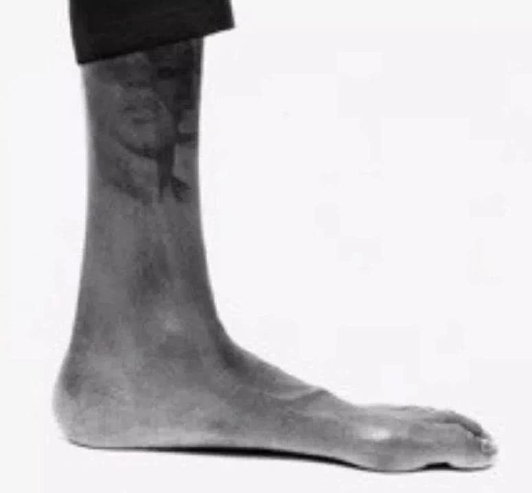 杜兰特为什么鞋总掉,杜兰特这个表现真的是跟腱断裂吗