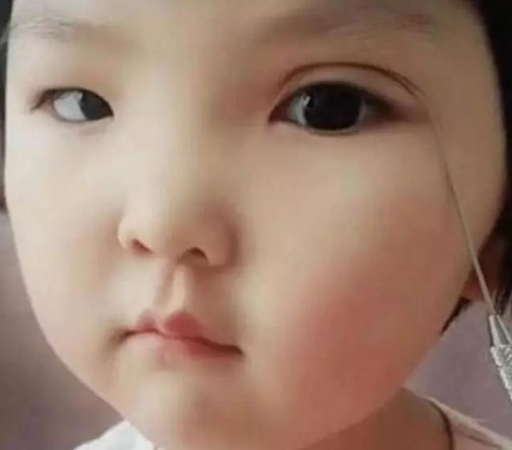 小孩怎样才能弄成双眼皮,怎么在家给孩子制作自然的双眼皮