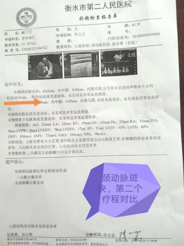 消斑散结治血管斑块中药,消斑溶栓通脉汤处方