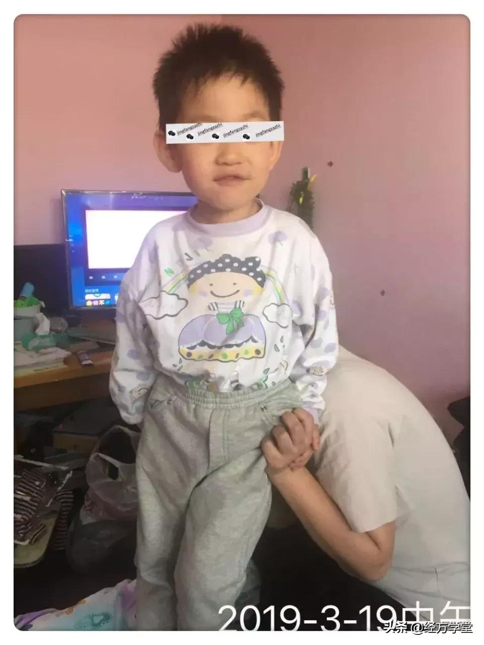 小柴胡汤加升降散医案,小柴胡颗粒治感冒后期咳嗽