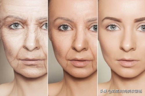 让法令纹和眼袋彻底消失的动作,法令纹怎么消除最快动作