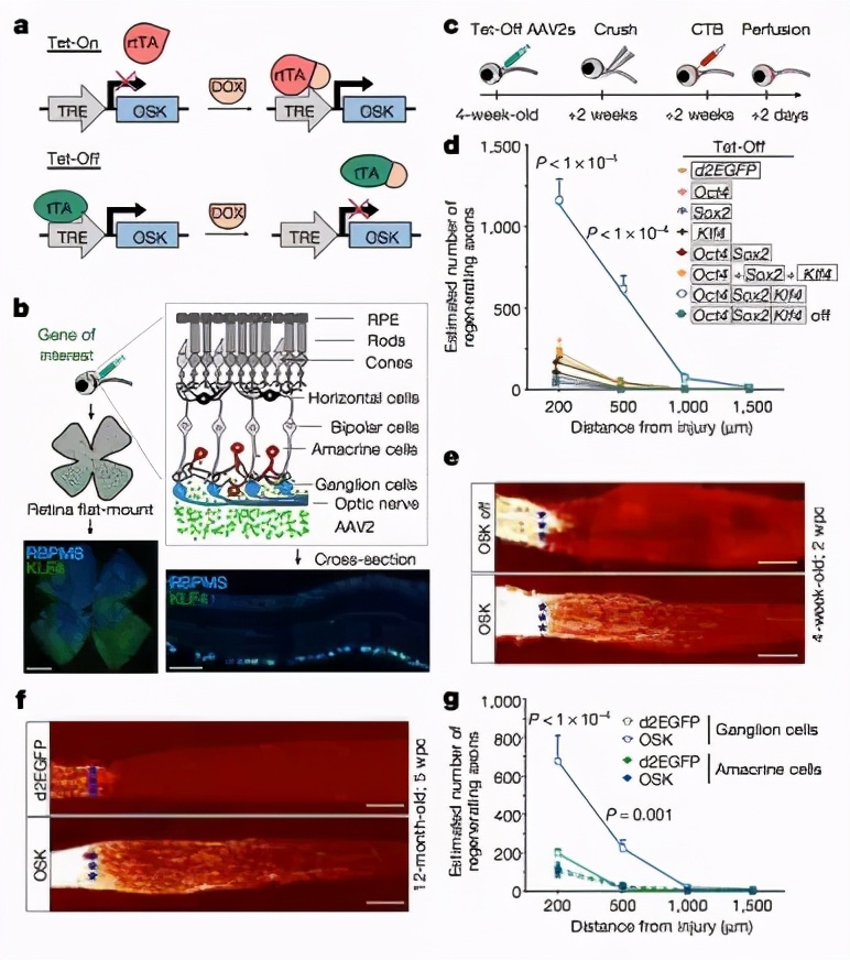 视力恢复研究突破,视力下降问题获重大突破
