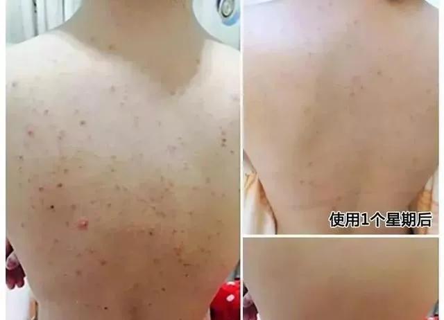 张嘉倪牛奶肌高清图,32岁张嘉倪全身照