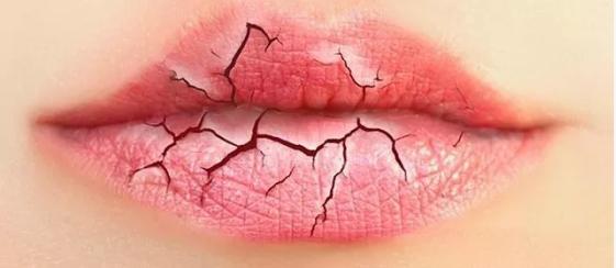 嘴唇干裂脱皮涂了润唇膏也没用,嘴唇干裂脱皮润唇膏女生推荐