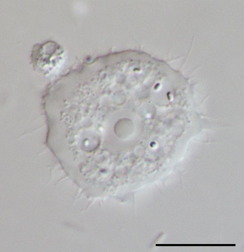 美瞳戴久了真的会瞎吗,戴了一次别人戴过的美瞳会怎么样