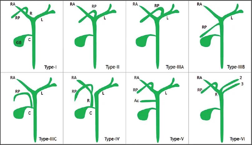 胆道系统解剖生理讲课视频,超声胆道系统的解剖生理