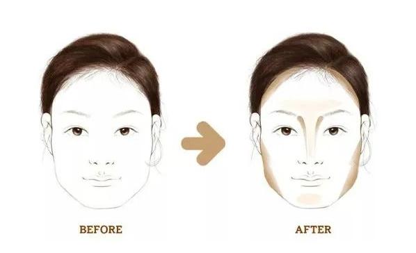 30岁下颌缘提升还有用吗,30岁下巴后缩能矫正吗