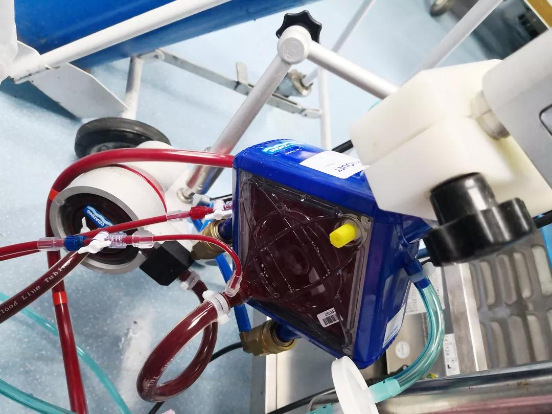 拉个肚子，心跳却突然没了！深圳“包租婆”为此两进ICU