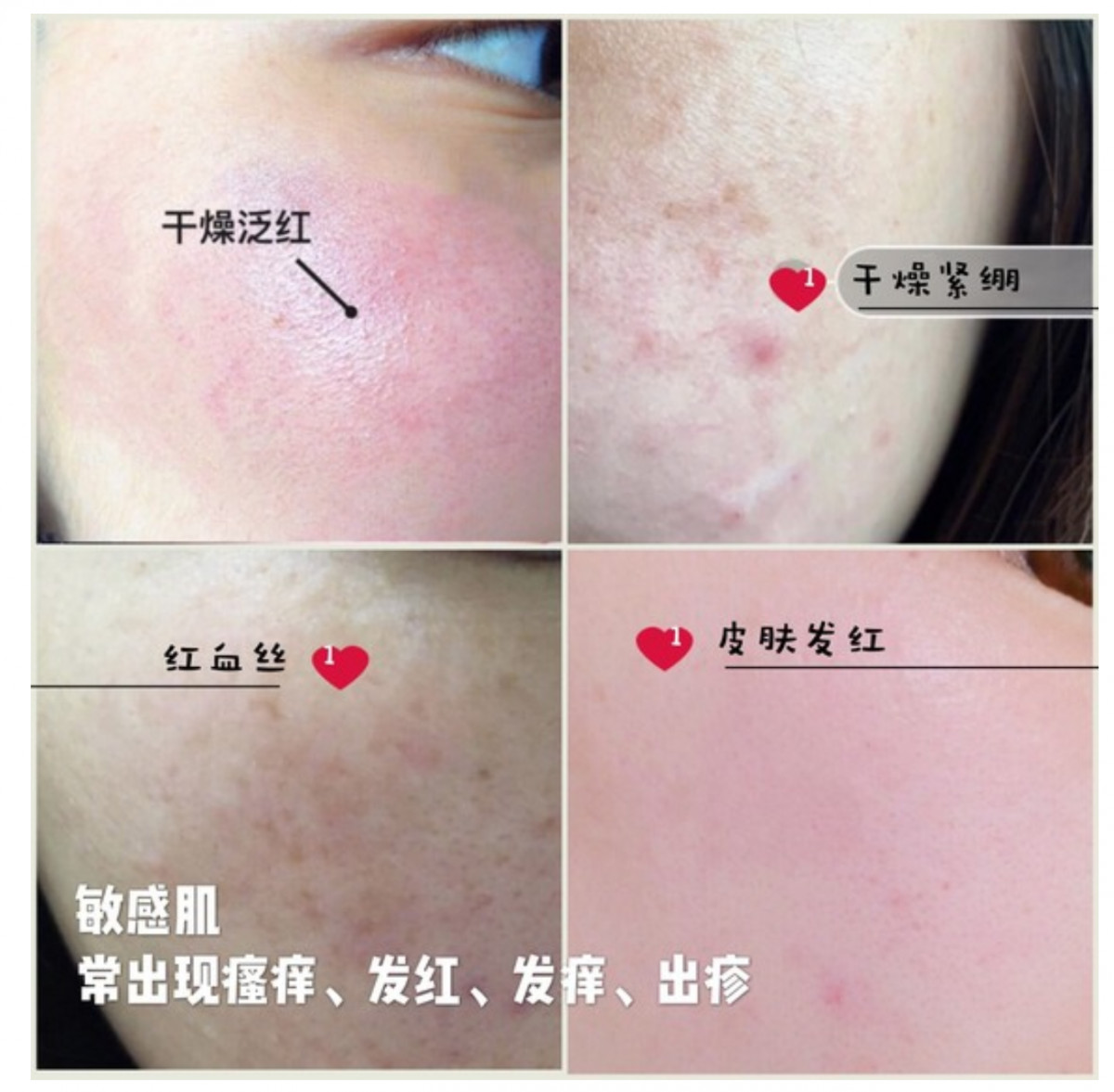 敏感肌肤护肤禁忌,敏感肌肤护肤正确方法