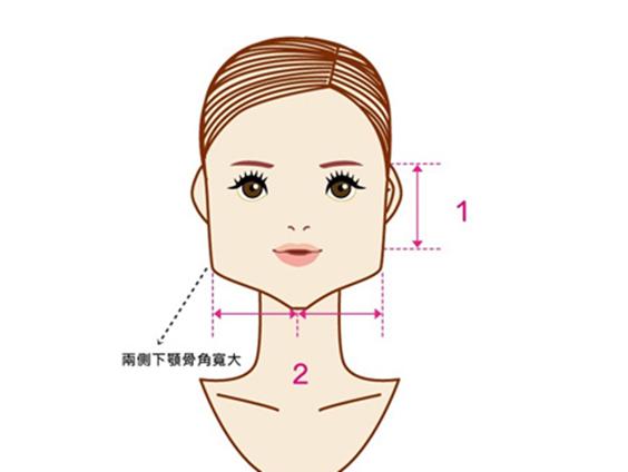 30多岁还能改善下巴后缩吗,30岁还能下颌后缩矫正吗