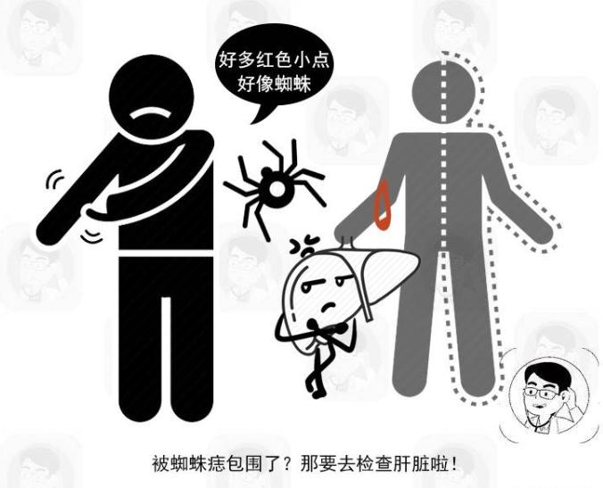 怎么判断痣是癌变还是普通痣,皮肤上长红痣要当心是肝病的征兆