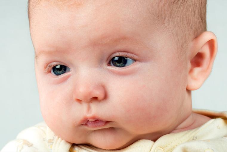 身上有湿疹全身痒得厉害该怎么办,湿疹感染了怎么处理