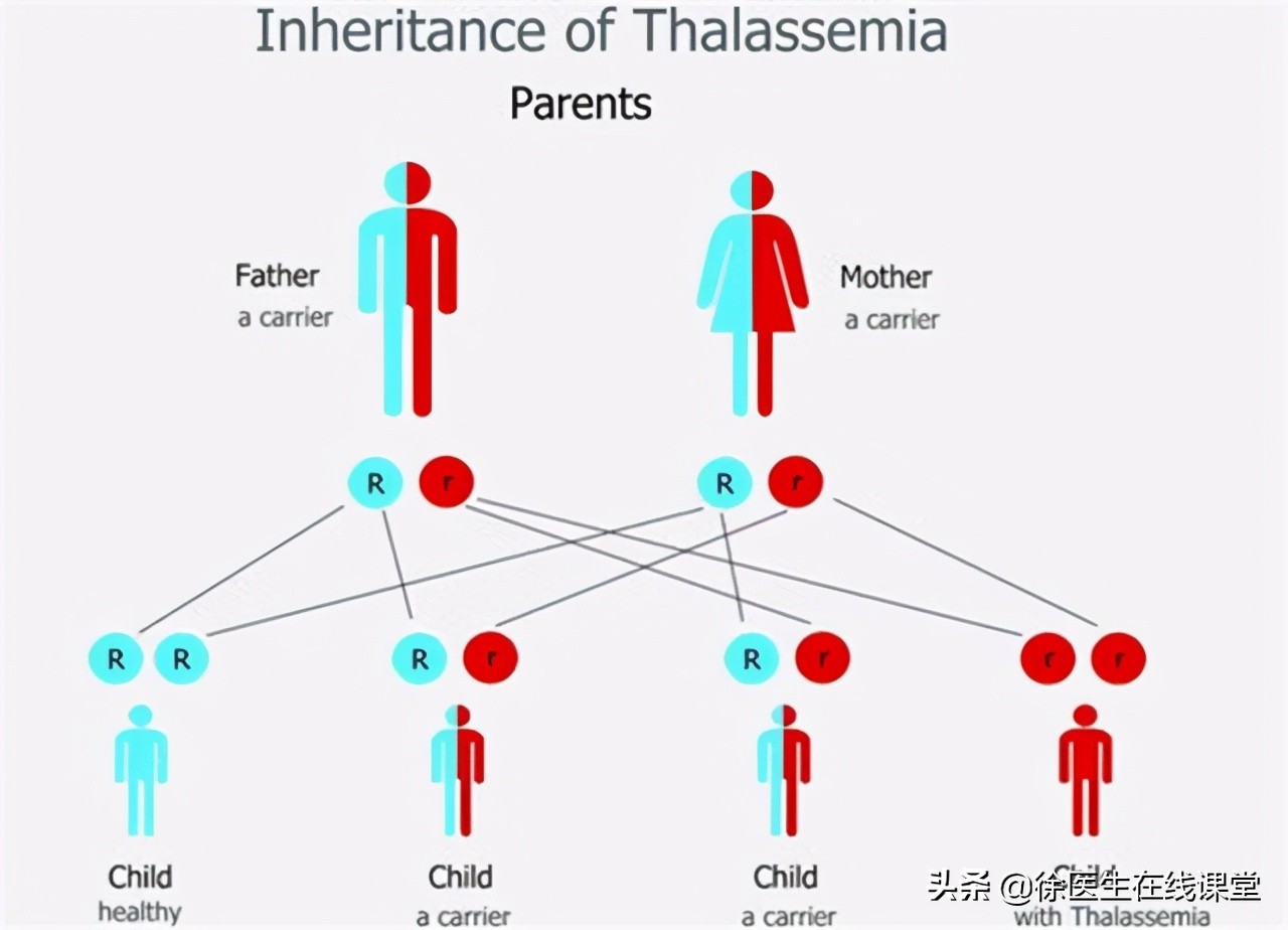 地中海贫血是什么样子,什么是地中海贫血会有什么症状