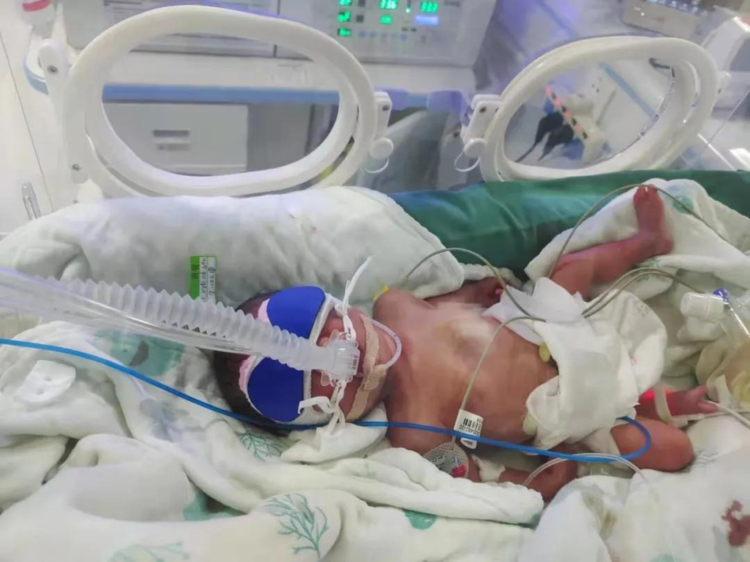 与生命赛跑重症转运全记录,生命接力危重症婴儿
