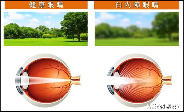 猫得了白内障怎么办,鸟得了白内障怎么办