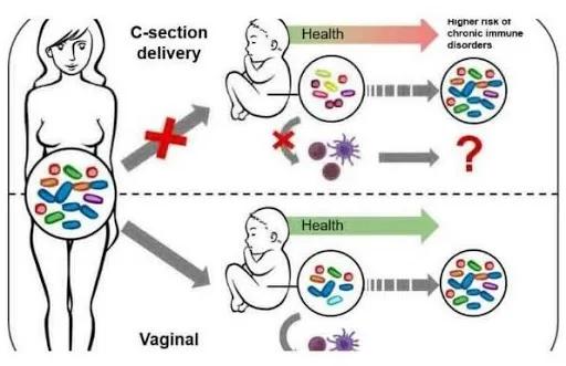 剖腹产经络割断了能恢复吗,剖腹产切断经络永久不能恢复吗