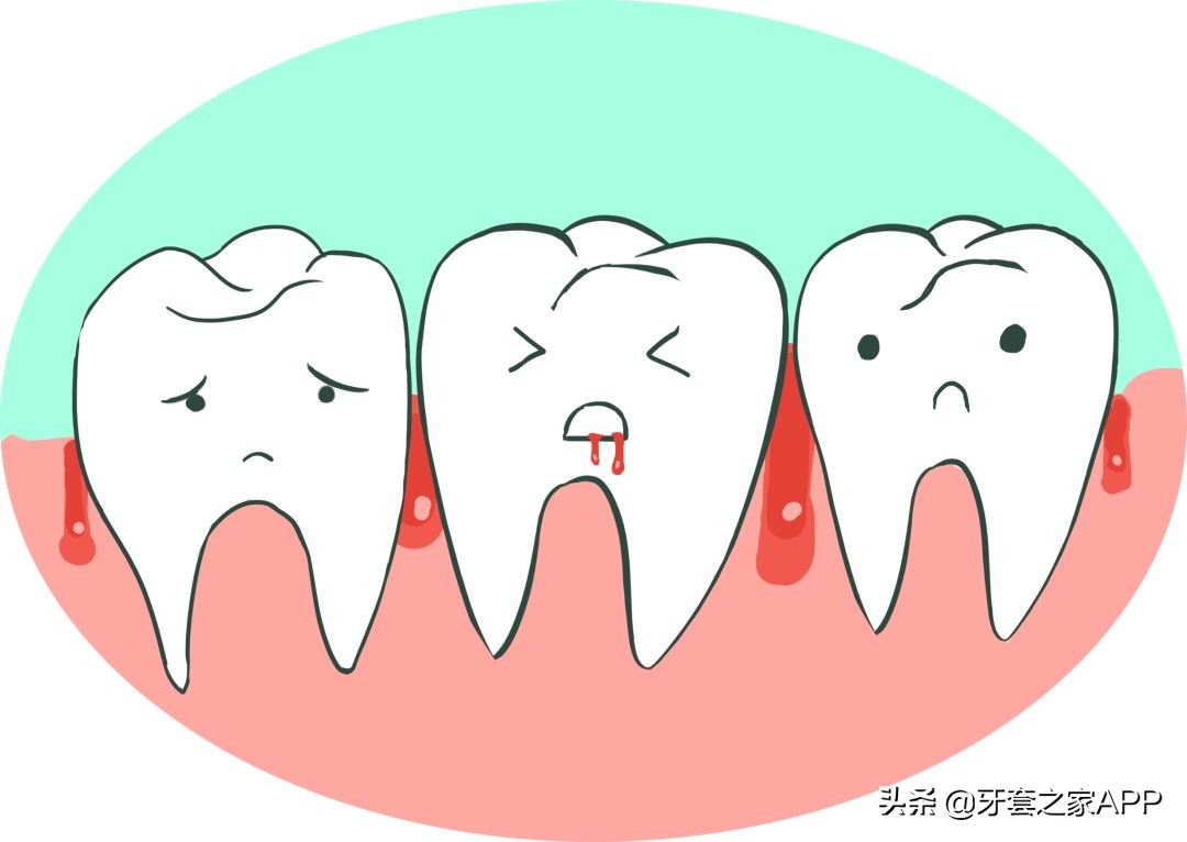 疫情复诊牙套能用吗现在,疫情期间牙齿出现问题怎么办