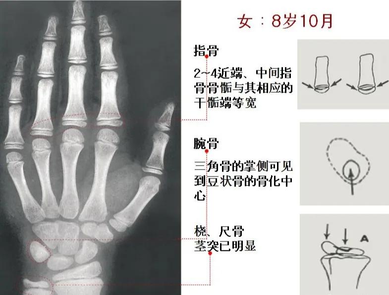 孩子个子高却跑不快,小孩个头不高