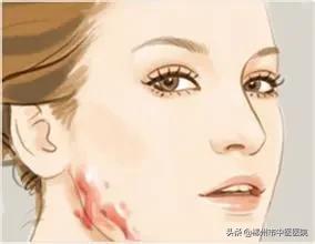 一受伤就会留疤,疤痕体质的疤凸起十几年了怎么治