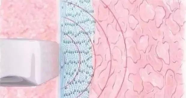 产后的你有没有漏尿的情况,产后漏尿又紧致最快恢复办法