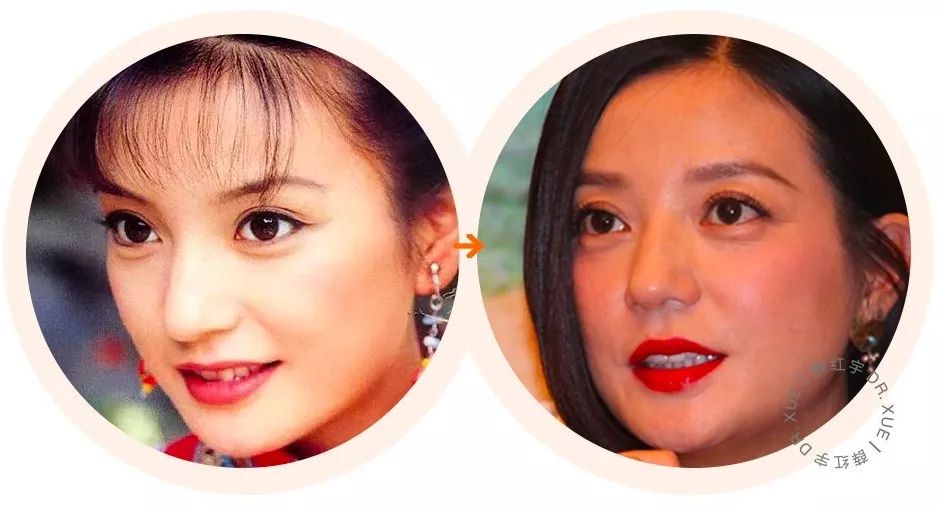 明星逃不过的年龄,明星都逃不过的衰老