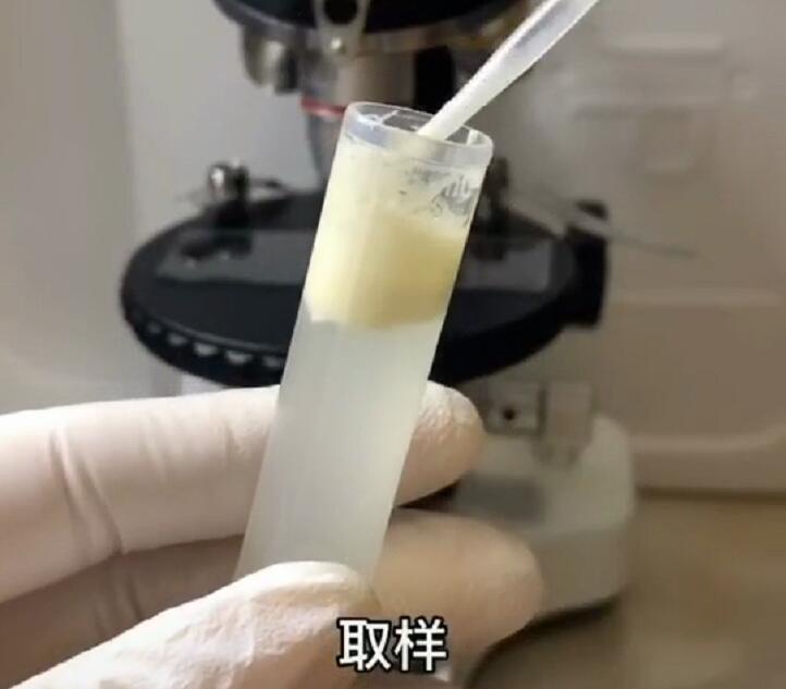 显微镜下的冷冻母乳,显微镜下母乳的营养成分