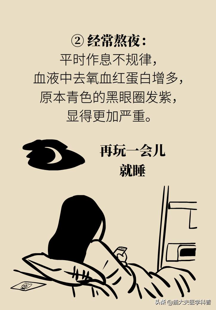 医生黑眼圈,手术消除黑眼圈靠谱吗