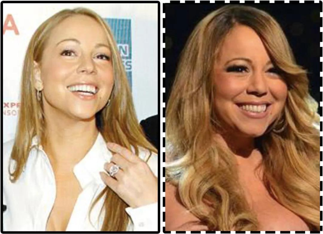 法令纹贴能消除法令纹吗,法令纹贴是怎样去除法令纹的