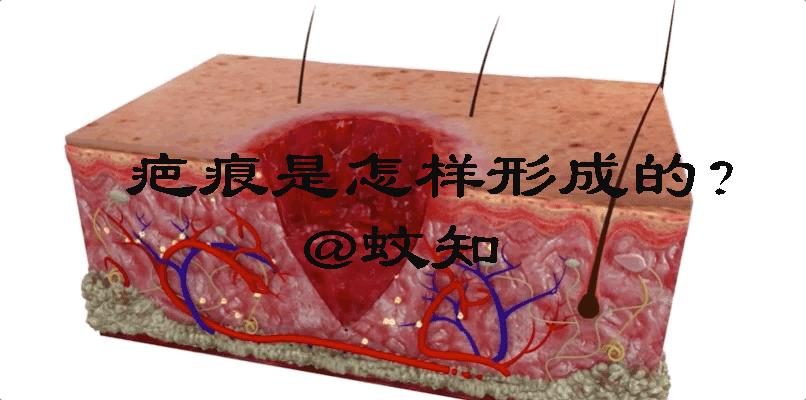 揭秘伤口如何愈合的,伤口是如何愈合的告诉小朋友